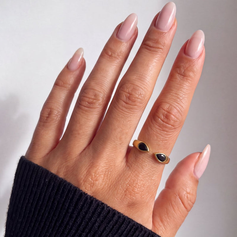 Anillo Viso